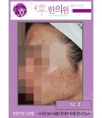 전후사진