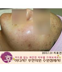 전후사진