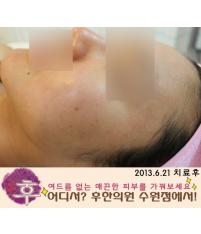 전후사진