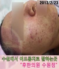 전후사진
