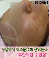 전후사진