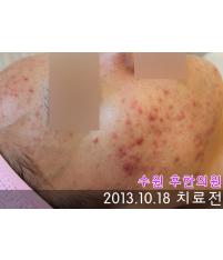 전후사진