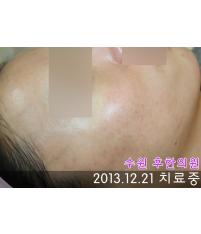 전후사진