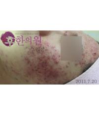 전후사진