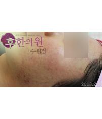 전후사진
