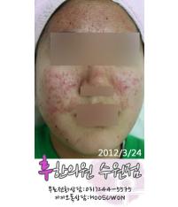 전후사진
