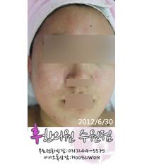 전후사진