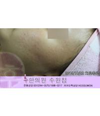 전후사진