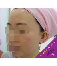 전후사진