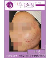 전후사진