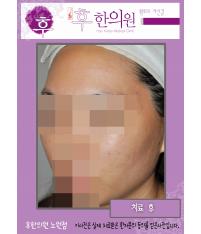 전후사진