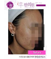 전후사진