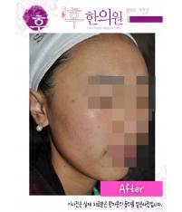 전후사진