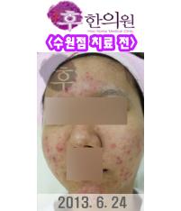 전후사진