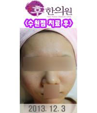 전후사진