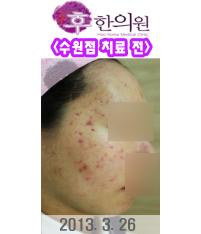 전후사진