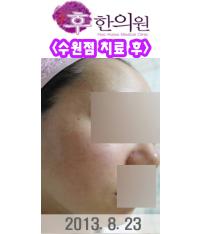 전후사진