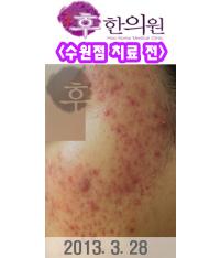 전후사진
