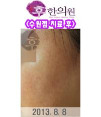 전후사진