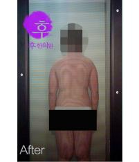 전후사진