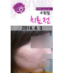 전후사진