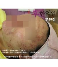 전후사진