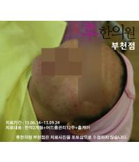 전후사진