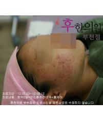 전후사진