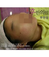 전후사진