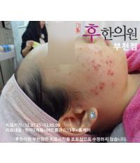 전후사진