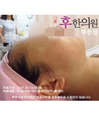 전후사진