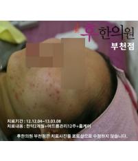 전후사진