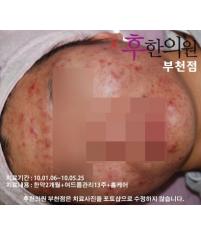 전후사진