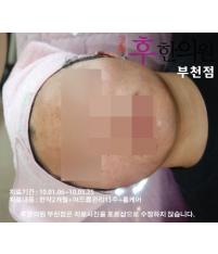 전후사진