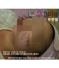 전후사진