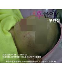 전후사진