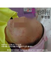 전후사진