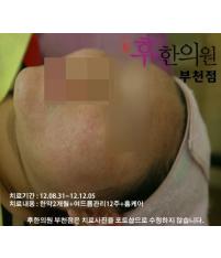 전후사진