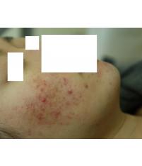 전후사진