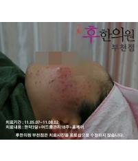 전후사진
