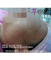 전후사진
