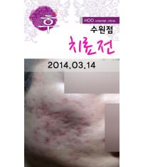 전후사진