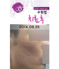 전후사진