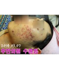 전후사진