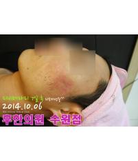 전후사진