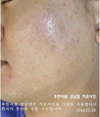 전후사진