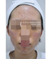 전후사진