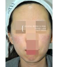 전후사진