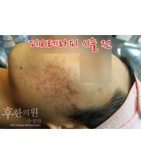 전후사진