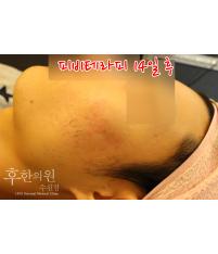 전후사진